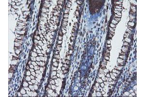 Image no. 2 for anti-SKI-Like Oncogene (SKIL) (AA 307-684) antibody (ABIN1491380) (SKIL 抗体  (AA 307-684))