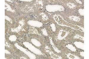ABIN6256137 and ABIN6267203 at 1/100 staining human normal kidney tissue by IHC-P.