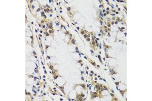Immunohistochemistry of paraffin-embedded human colon using C antibody (ABIN6127552, ABIN6137952, ABIN6137953 and ABIN6216977) at dilution of 1:100 (40x lens). (CASC5 抗体  (AA 1-300))