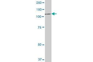 EEF2K MaxPab polyclonal antibody. (EEF2K 抗体  (AA 1-725))