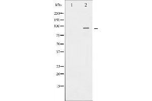 Western blot analysis of Catenin-β expression in 293 whole cell lysates,The lane on the left is treated with the antigen-specific peptide. (CTNNB1 抗体  (N-Term))