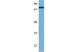 WB Suggested Anti-Masp2 Antibody Titration:  1 ug/ml  Sample Type:  HeLa (MASP2 抗体  (Middle Region))