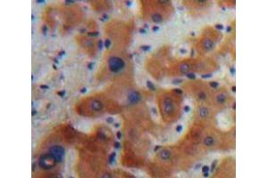 Used in DAB staining on fromalin fixed paraffin-embedded Liver tissue (Caspase 7 抗体  (AA 24-198))
