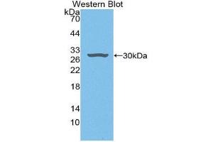 Western Blotting (WB) image for anti-Hepatoma-Derived Growth Factor (HDGF) (AA 10-240) antibody (ABIN1868349) (HDGF 抗体  (AA 10-240))