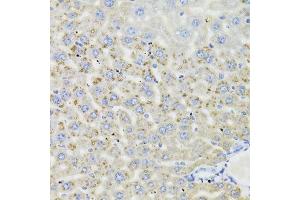 Immunohistochemistry (Paraffin-embedded Sections) (IHC (p)) image for anti-Hydroxysteroid (17-Beta) Dehydrogenase 13 (HSD17B13) (AA 20-300) antibody (ABIN6142006)