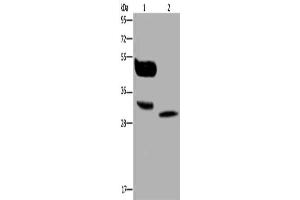 Gel: 10 % SDS-PAGE, Lysate: 40 μg, Lane 1-2: A375 cells, human lung cancer tissue, Primary antibody: ABIN7130137(MAGEA8 Antibody) at dilution 1/400, Secondary antibody: Goat anti rabbit IgG at 1/8000 dilution, Exposure time: 30 seconds (MAGEA8 抗体)