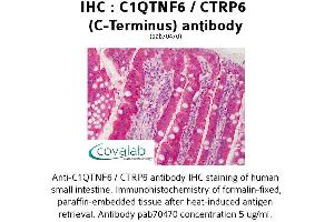 Image no. 1 for anti-Complement C1q Tumor Necrosis Factor-Related Protein 6 (C1QTNF6) antibody (ABIN1732486) (CTRP6 抗体)
