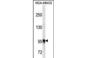 PLOD3 Antibody (N-term) (ABIN656661 and ABIN2845902) western blot analysis in MDA-M cell line lysates (35 μg/lane). (PLOD3 抗体  (N-Term))