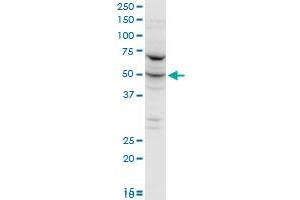 FARSLA polyclonal antibody (A01), Lot # 060102JC01. (Phenylalanyl-tRNA Synthetase, alpha Subunit (FARSA) (AA 101-201) 抗体)