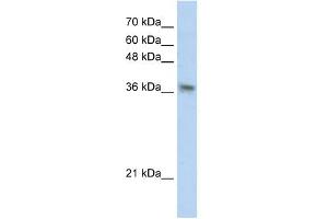 PHYHIP antibody used at 1 ug/ml to detect target protein. (PHYHIP 抗体  (N-Term))