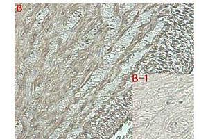 Immunohistochemical staining of human tissue using anti-DLK1 (human), mAb (PF13-3)  at 1:500 dilution. (DLK1 抗体  (Extracellular Domain))