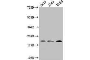 Western Blot Positive WB detected in: Hela whole cell lysate, A549 whole cell lysate, HL60 whole cell lysate All lanes: HIST1H1C antibody at 1:500 Secondary Goat polyclonal to rabbit IgG at 1/40000 dilution Predicted band size: 22 kDa Observed band size: 22 kDa (HIST1H1C 抗体)