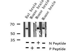 Western blot analysis of Phospho-COT (Thr290) expression in various lysates (MAP3K8 抗体  (pThr290))