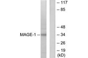 Western blot analysis of extracts from HepG2 cells, using MAGE-1 Antibody. (MAGEA1 抗体  (AA 260-309))