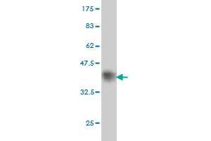 Western Blot detection against Immunogen (38. (ULK1 抗体  (AA 602-715))