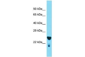 Western Blotting (WB) image for anti-Mediator Complex Subunit 29 (MED29) (Middle Region) antibody (ABIN2789154) (MED29 抗体  (Middle Region))