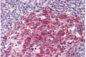 anti-General Transcription Factor IIA, 1, 19/37kDa (GTF2A1) (AA 281-330) antibody