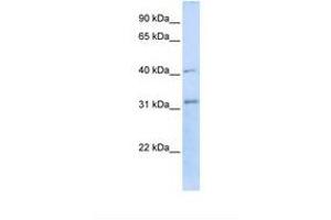 Image no. 1 for anti-STIP1 Homology and U-Box Containing Protein 1 (STUB1) (AA 218-267) antibody (ABIN6738054)