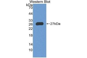Western Blotting (WB) image for anti-Forkhead Box P1 (FOXP1) (AA 461-671) antibody (ABIN2119330) (FOXP1 抗体  (AA 461-671))