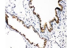 IHC-P: GSTP1 antibody testing of rat lung tissue (GSTP1 抗体  (AA 2-210))