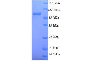 SDS-PAGE (SDS) image for SMAD, Mothers Against DPP Homolog 2 (SMAD2) (AA 2-467), (full length) protein (His tag) (ABIN1047400) (SMAD2 Protein (AA 2-467, full length) (His tag))