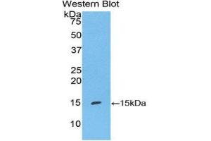 Western Blotting (WB) image for anti-S100 Calcium Binding Protein A7 (S100A7) (AA 1-108) antibody (ABIN1860486) (S100A7 抗体  (AA 1-108))