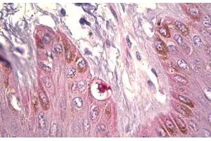 Anti-DCT antibody IHC staining of human skin, melanocytes. (DCT 抗体  (AA 51-100))