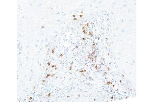 Immunohistochemistry (IHC) image for anti-Inducible T-Cell Co-Stimulator (ICOS) (AA 149-199) antibody (ABIN7453973) (Recombinant ICOS 抗体  (AA 149-199))