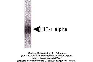 Image no. 1 for anti-Hypoxia Inducible Factor 1, alpha Subunit (Basic Helix-Loop-Helix Transcription Factor) (HIF1A) (AA 329-530) antibody (ABIN363215) (HIF1A 抗体  (AA 329-530))