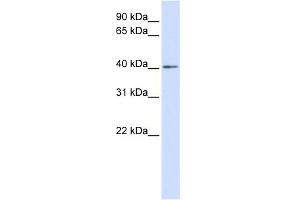 WB Suggested Anti-NKX3-2 Antibody Titration: 0. (NKX3-2 抗体  (Middle Region))