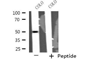 Western blot analysis of extracts from COLO cells, using STK24 antibody. (STK24 抗体  (N-Term))