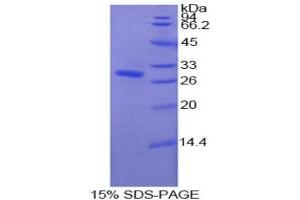 SDS-PAGE analysis of Human Pyridoxal Kinase Protein. (PDXK 蛋白)