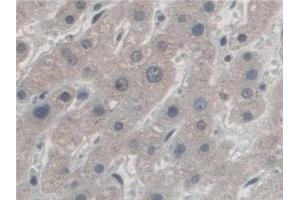 Detection of AZIN1 in Human Liver Tissue using Polyclonal Antibody to Antizyme Inhibitor 1 (AZIN1) (Antizyme Inhibitor 1 抗体  (AA 5-290))