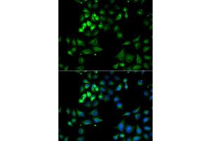 Immunofluorescence analysis of A549 cell using HYOU1 antibody. (HYOU1 抗体)