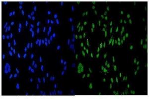 IF analysis of HDAC9 using anti-HDAC9 antibody (ABIN7602333). (HDAC9 抗体  (AA 7-469))