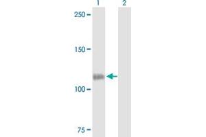 Western Blotting (WB) image for anti-Colony Stimulating Factor 2 Receptor, Beta (CSF2RB) (AA 1-889) antibody (ABIN514676)