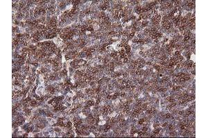 Immunohistochemistry (IHC) image for anti-T-cell surface glycoprotein CD1c (CD1C) antibody (ABIN2670658) (CD1c 抗体)