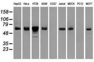 Image no. 10 for anti-Checkpoint Kinase 2 (CHEK2) antibody (ABIN1497496)