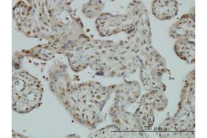 Immunostaining (ISt) image for anti-Cullin-Associated and Neddylation-Dissociated 1 (CAND1) (AA 1-100) antibody (ABIN565932)