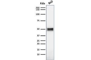 Western Blot Analysis of Raji cell lysate using CD79a Mouse Monoclonal Antibody (HM47/A9). (CD79a 抗体  (AA 202-216))