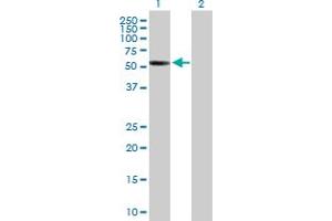 Western Blot analysis of CDYL2 expression in transfected 293T cell line by CDYL2 MaxPab polyclonal antibody. (CDYL2 抗体  (AA 1-506))