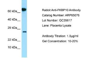 Western Blotting (WB) image for anti-FK506 Binding Protein 10, 65 KDa (FKBP10) (N-Term) antibody (ABIN2790034) (FKBP10 抗体  (N-Term))