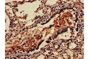 Immunohistochemistry of paraffin-embedded human lung tissue using ABIN7175192 at dilution of 1:100 (VSIG4 抗体  (AA 20-283))