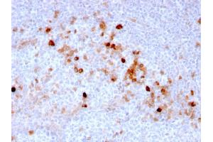 Formalin-fixed, paraffin-embedded human Tonsil stained with Endoglin / CD105 Mouse Monoclonal Antibody (ENG/3269). (Endoglin 抗体  (AA 74-251))