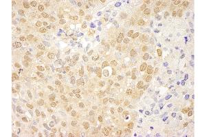 Immunohistochemistry (IHC) image for anti-C-Abl Oncogene 1, Non-Receptor tyrosine Kinase (ABL1) (AA 850-900) antibody (ABIN7448914) (ABL1 抗体  (AA 850-900))
