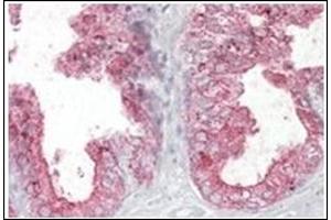 Image no. 1 for anti-Kallikrein 2 (KLK2) (Internal Region) antibody (ABIN374827) (Kallikrein 2 抗体  (Internal Region))