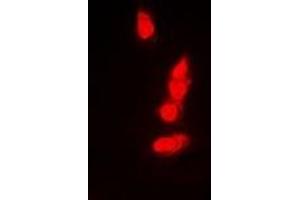 Immunofluorescence (IF) image for anti-Proteasome (Prosome, Macropain) Subunit, beta Type, 8 (Large Multifunctional Peptidase 7) (PSMB8) antibody (ABIN7307018)