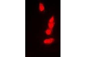 Immunofluorescent analysis of PSMB8 staining in A549 cells. (PSMB8 抗体)