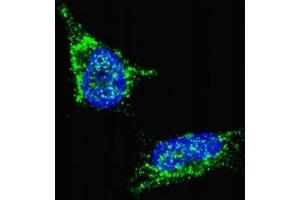 Fluorescent confocal image of SY5Y cells stained with LIN28B antibody. (LIN28B 抗体  (AA 1-30))