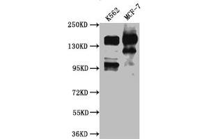 Western Blot Positive WB detected in: K562 whole cell lysate, MCF-7 whole cell lysate All lanes: mSin3A antibody at 1:1000 Secondary Goat polyclonal to rabbit IgG at 1/50000 dilution Predicted band size: 146 kDa Observed band size: 146 kDa